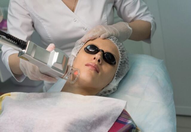 Feldverjüngung durch einen Laser